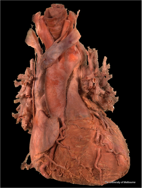 Cadaveric Anatomy